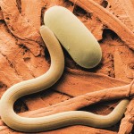 Soybean cyst nematode and egg.