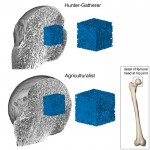 human bone density graphic