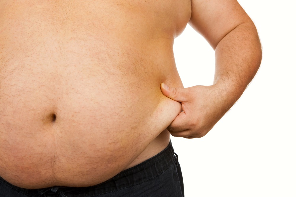 Overweight
