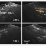 A study has found the grain is an ideal and safe contrast agent for diagnosing swallowing disorders. PHOTO: UNIVERSITY AT BUFFALO