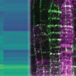 The Clasp protein, seen here in an image from an electron microscope,
helps cells divide within the roots and shoots of the thale cress plant.