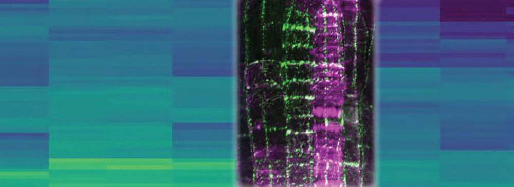 The Clasp protein, seen here in an image from an electron microscope,  helps cells divide within the roots and shoots of the thale cress plant.