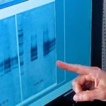 A Western blot analysis, used to confirm BSE in bovine brain tissue. (Peggy Greb photo courtesy ARS/USDA)