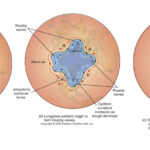 Rossby waves in the northern hemisphere. At any given time, there will typically be between four and six Rossby waves at different stages of development in the Northern Hemisphere.
