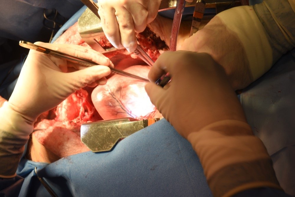 A view of the pig heart used in the transplant, before its removal from the pig, on Jan. 7, 2022. (Medschool.umaryland.edu)
