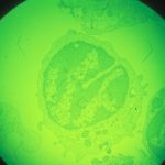 A macrophage (immune response) cell in early stages of infection with African swine fever virus, magnified about 1,000x. (Keith Weller photo courtesy ARS/USDA)
