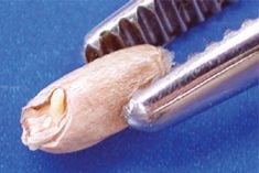 A sprouted wheat kernel, with the sprout within the contour of the germ, is classified as “regular sprouted.”