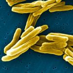 Tuberculosis bacteria under an electron microscope. (Janice Haney Carr photo courtesy Centers for Disease Control and Prevention (U.S.))
