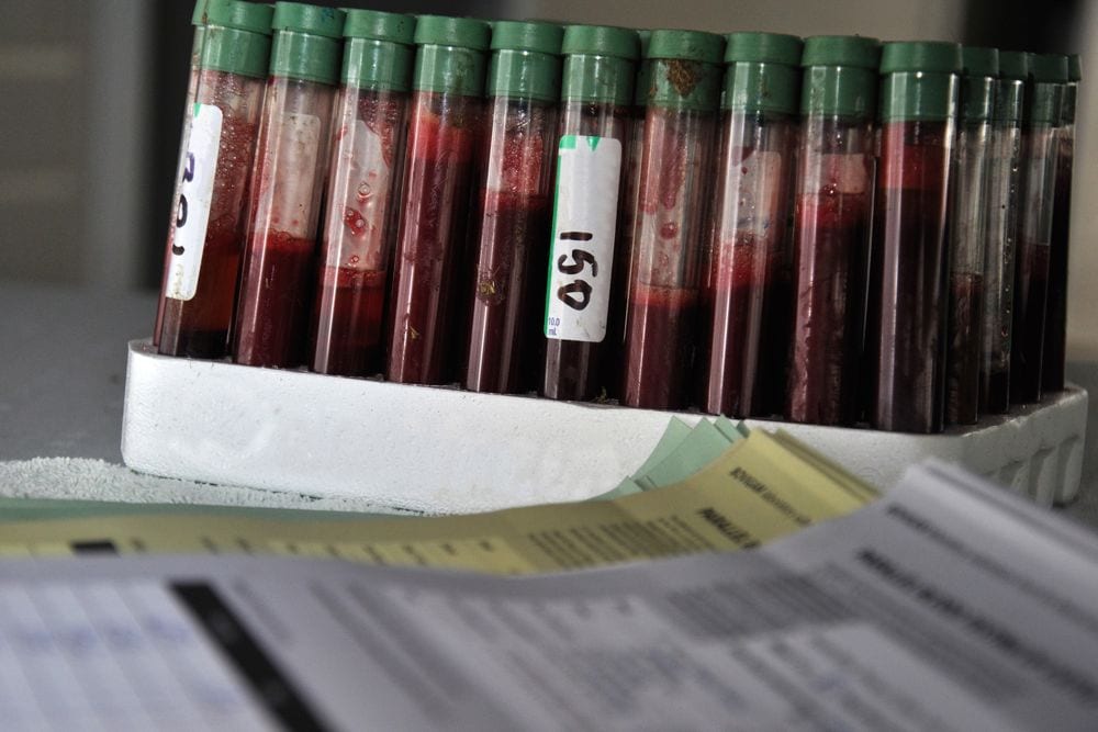 This file photo shows a rack of blood samples being tested for bovine tuberculosis in New Zealand dairy cattle. (Lakeview_Images/iStock/Getty Images)
