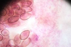 A liver fluke parasite under light microscopy.