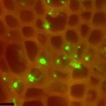 This image, captured using fluorescent microscopy, shows verticillium hyphae (in green) colonizing cells of root vascular tissue (in red).