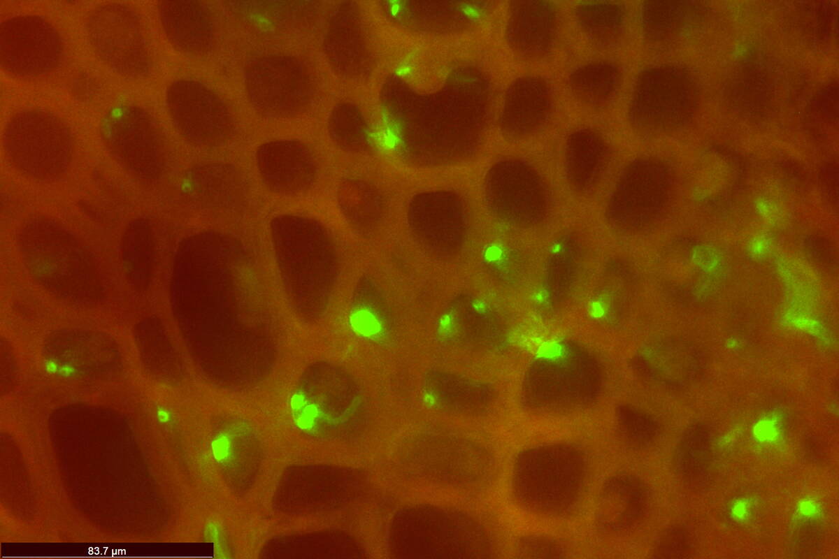 This image, captured using fluorescent microscopy, shows verticillium hyphae (in green) colonizing cells of root vascular tissue (in red).