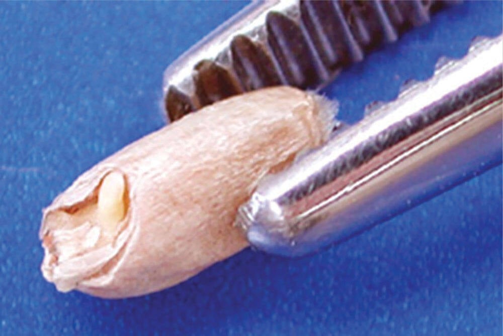 A sprouted wheat kernel, with the sprout within the contour of the germ as shown here, is classified as “regular sprouted” as opposed to