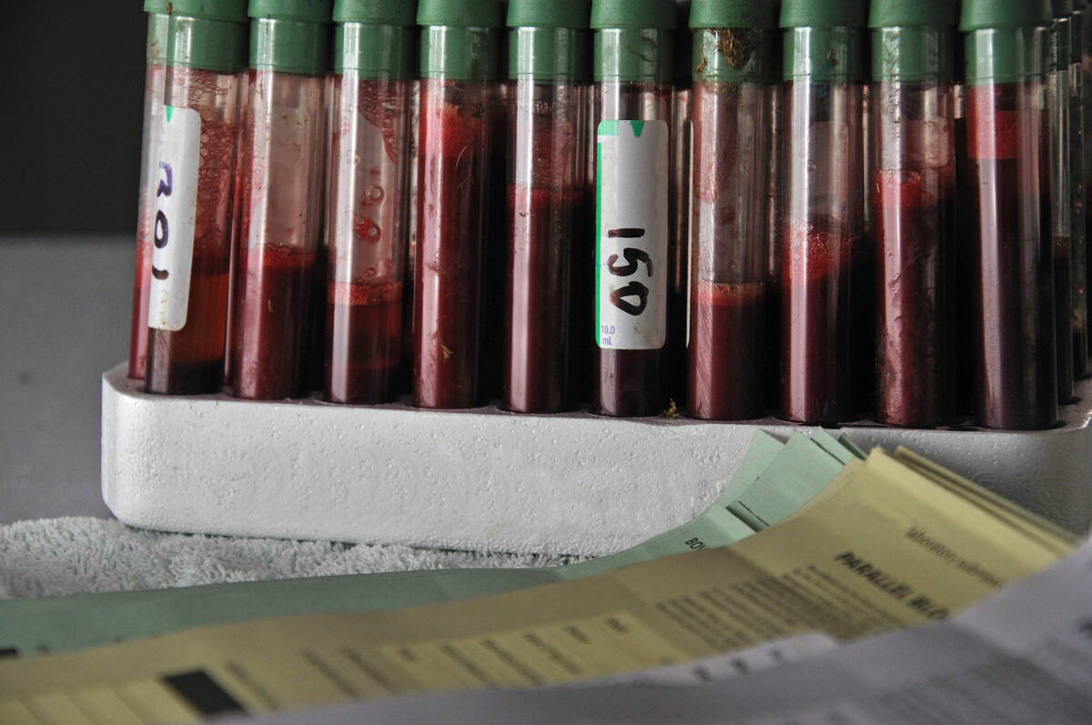 File photo of a rack of blood samples in tests for bovine tuberculosis in New Zealand. Photo: Lakeview_Images/iStock/Getty Images