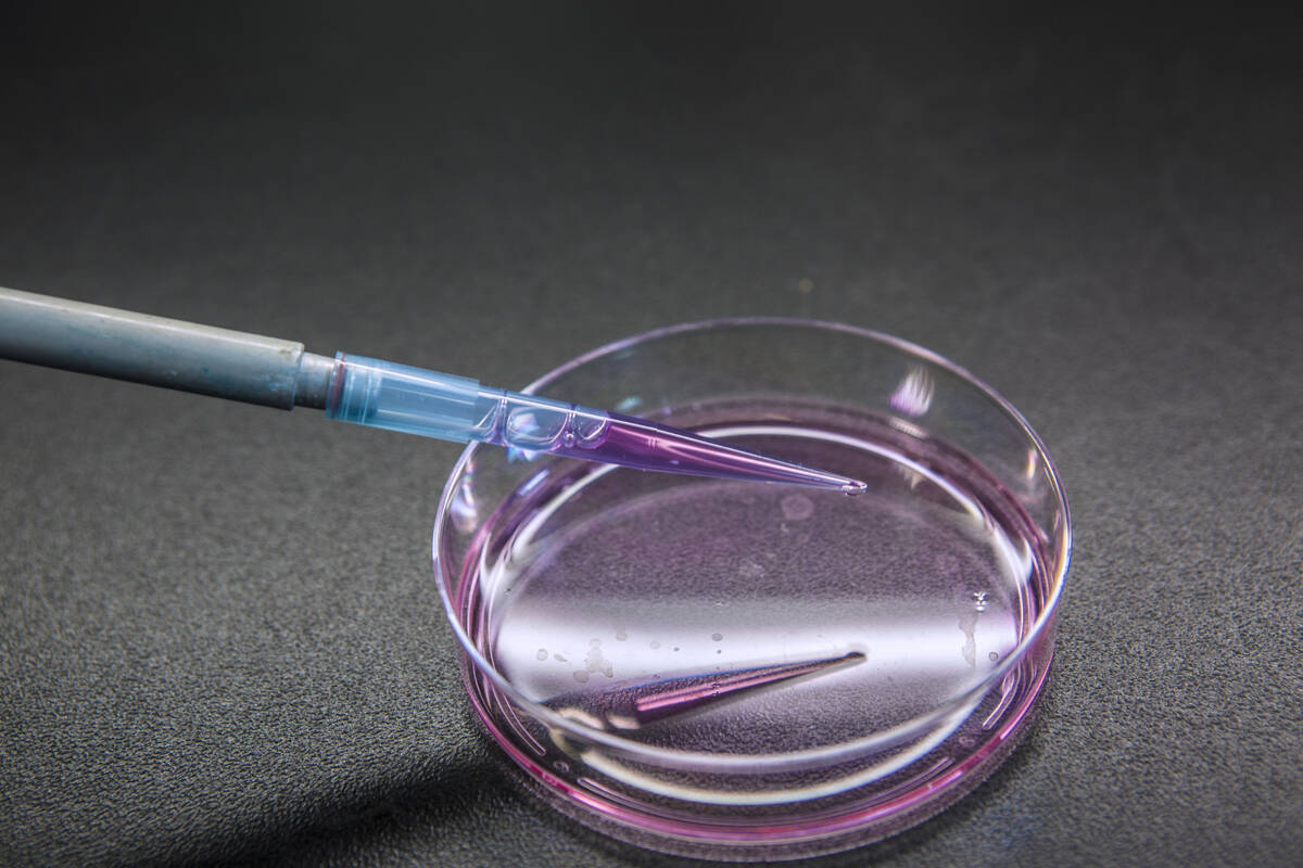 Special laboratory equipment is used in special or research laboratory. These technologies are applied for many cancer biology researches or pharmacology to improve patient treatment. Photo: Nilrat Wannasilp/iStock/Getty Images