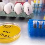 PHOTO: DIGICOMPHOTO/SCIENCE LIBRARY/ISTOCK/GETTY IMAGES
