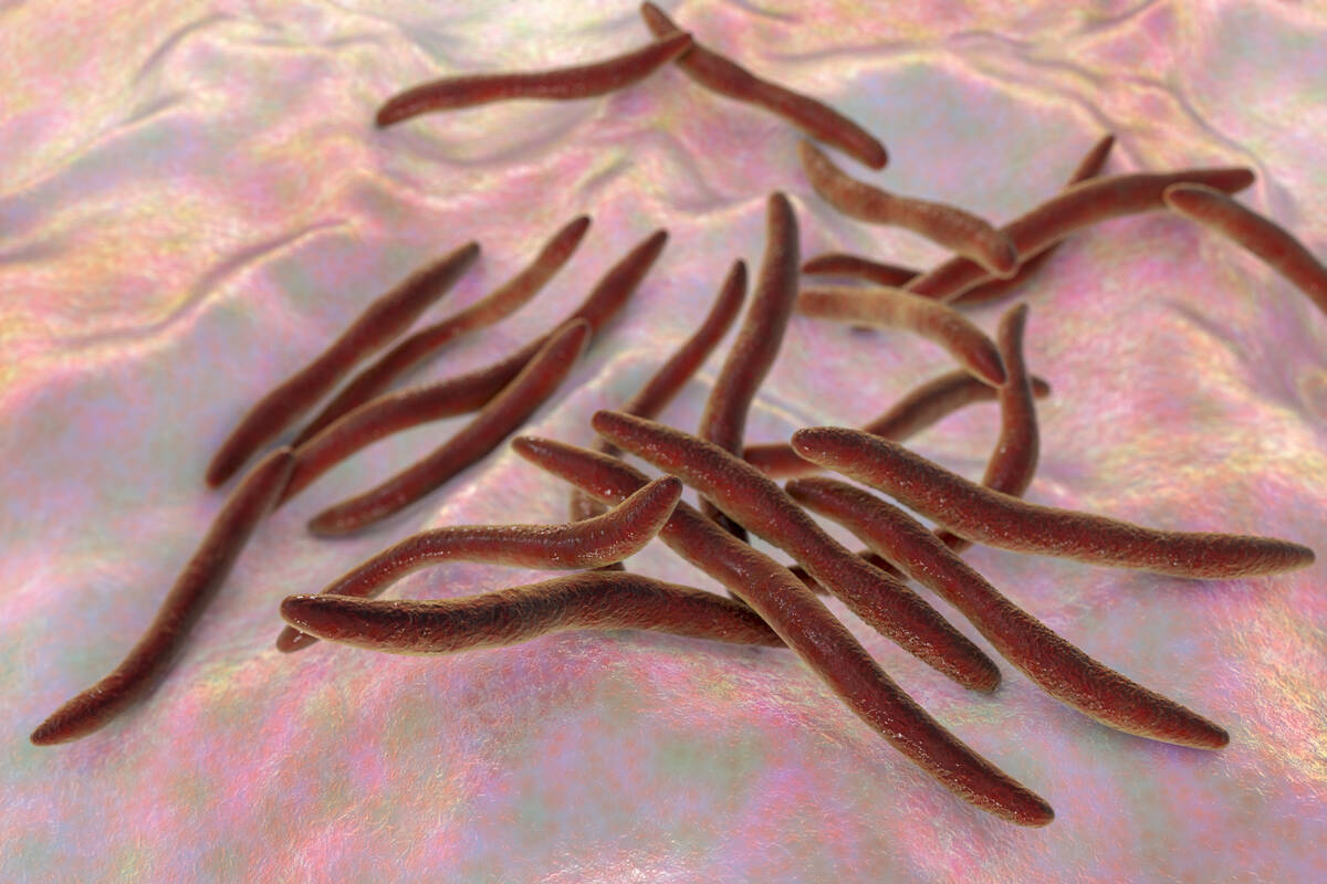 A computer illustration of fusobacteria. The F. necrophorum pathogen, which has been linked to necrotic diseases in other species, is too prevalent to be eliminated from the hog barn environment, so preventing infections is the better strategy. Photo: Dr_Microbe/iStock/Getty Images
