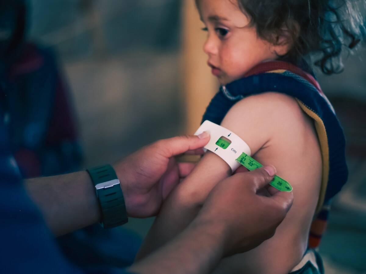 A doctor examines children’s malnutrition in a refugee camp in Syria in 2025. Photo: Mohammad Bash/iStock/Getty Images